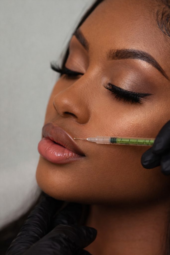 Lip Flip with Botox Toxin Mobile Aesthetics MD Metro Atlanta Georgia Nurse Injector Shana