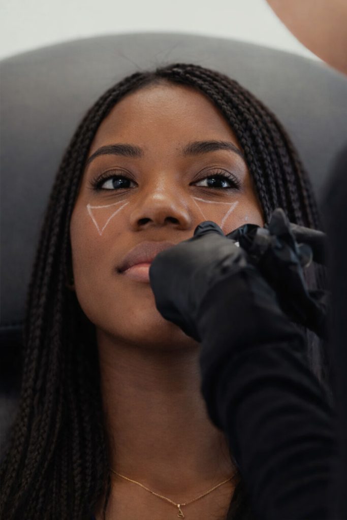 Chin dermal fillers by Mobile Aesthetics MD Metro Atlanta Georgia Nurse Injector Shana