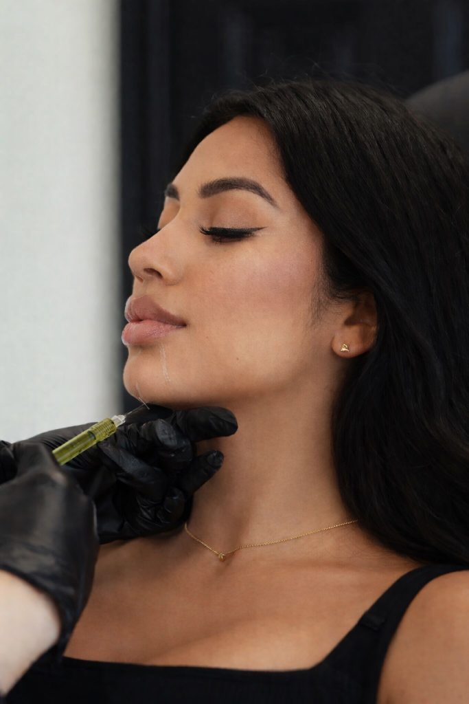 Chin filler by Mobile Aesthetics MD Metro Atlanta Georgia Nurse Injector Shana