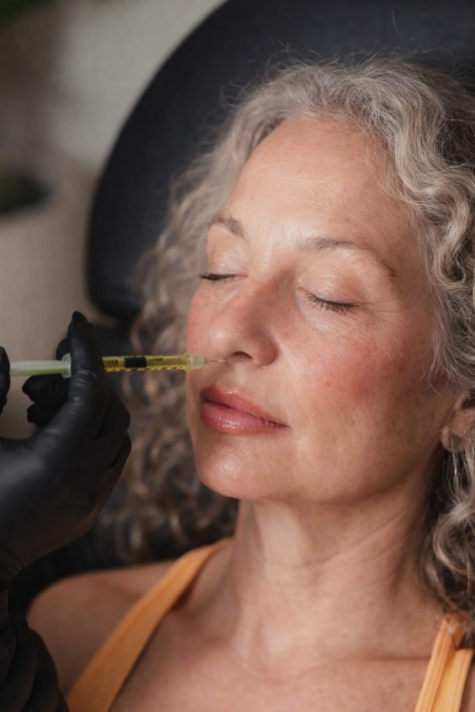 Gummy lines Derma Fillers by Mobile Aesthetics MD Metro Atlanta Georgia Nurse Injector Shana